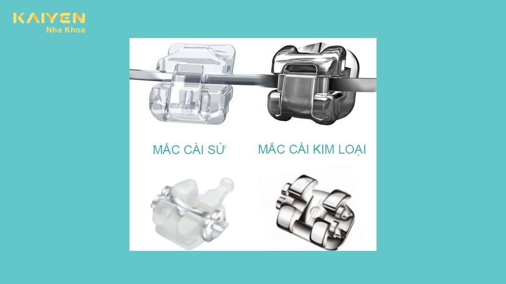 Chất liệu mắc cài