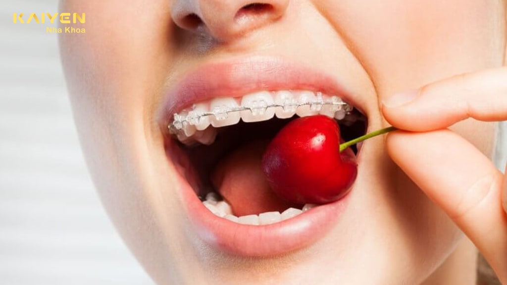 Sự khác nhau về khả năng ăn nhai giữa hai loại mắc cài