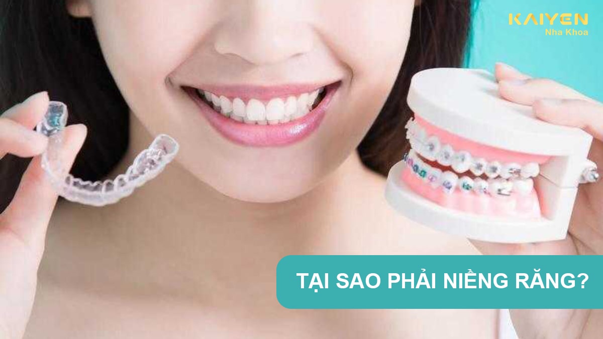 Tại sao phải niềng răng