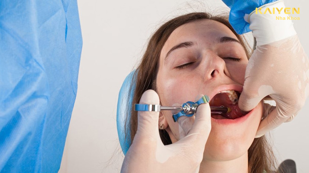 Sử dụng thuốc tê là yếu tố giải đáp câu hỏi trồng răng implant có đau không?