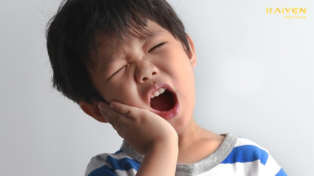 áp xe răng ở trẻ em là gì?