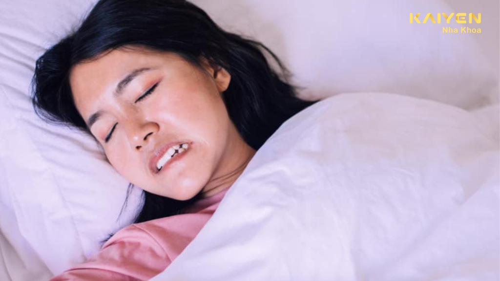 Nguyên nhân nghiến răng khi ngủ