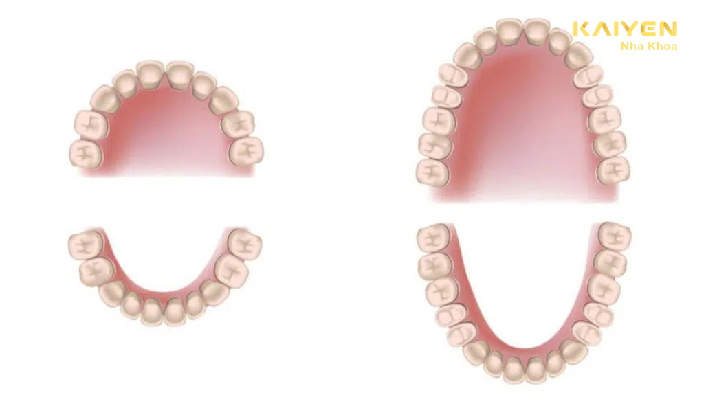 Cách phân biệt răng sữa và răng vĩnh viễn