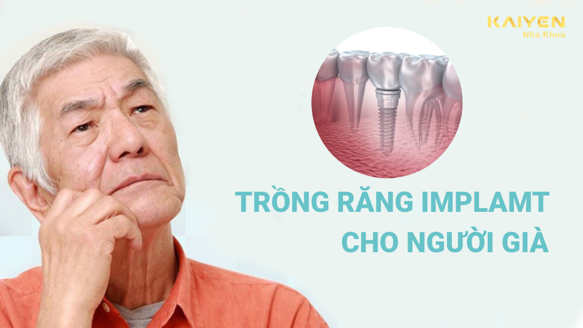 Trồng răng Implant cho người già có được không? Chi phí răng giả bao nhiêu?