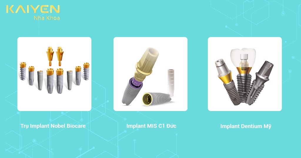 Trồng răng cửa Implant: Loại nào tốt nhất và giá bao nhiêu?