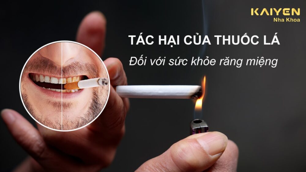 Tác hại của thuốc lá đối với sức khỏe răng miệng