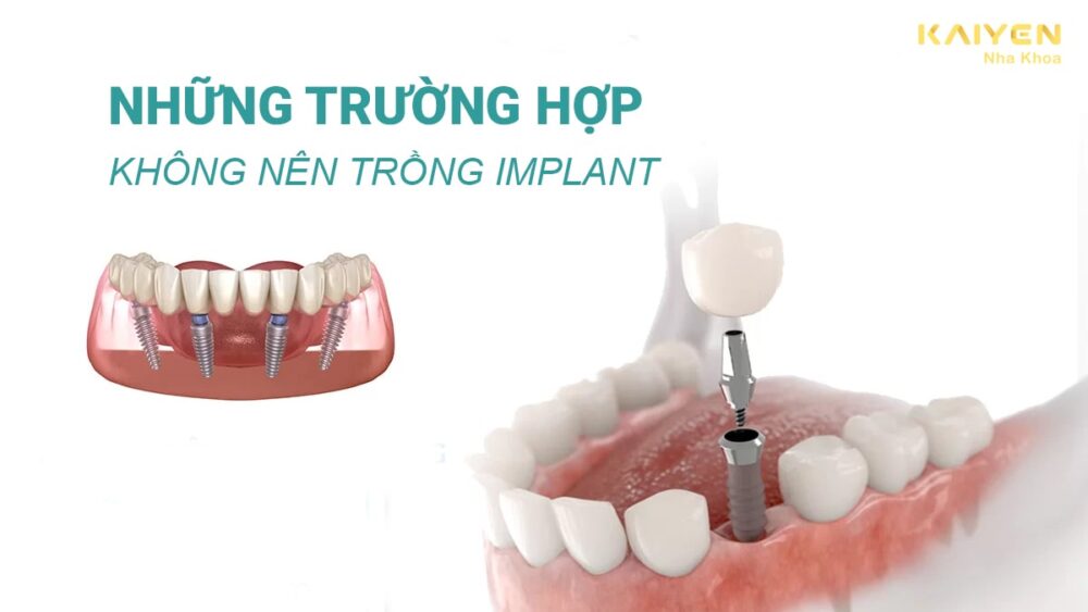 Những trường hợp không nên trồng Implant