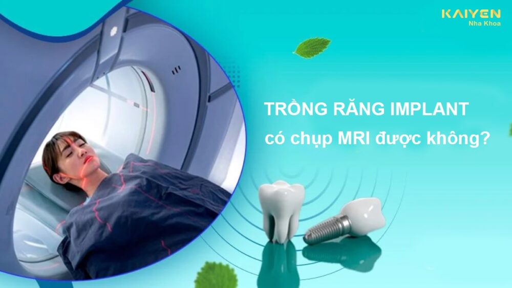 Trồng răng Implant có chụp MRI được không?