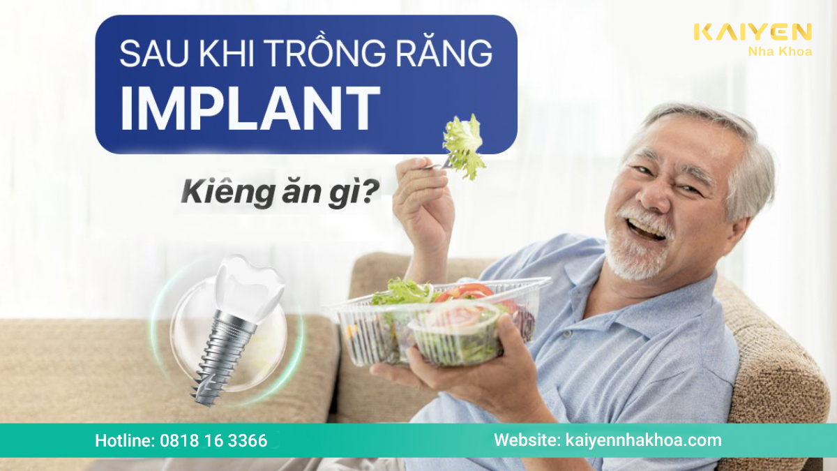 Sau khi trồng răng implant kiêng ăn gì?