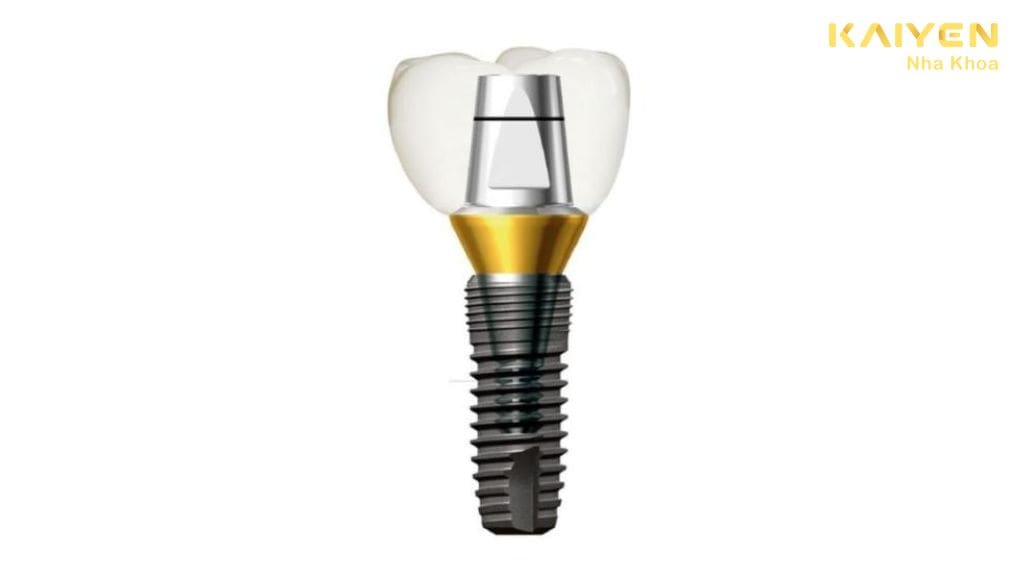 trụ implant