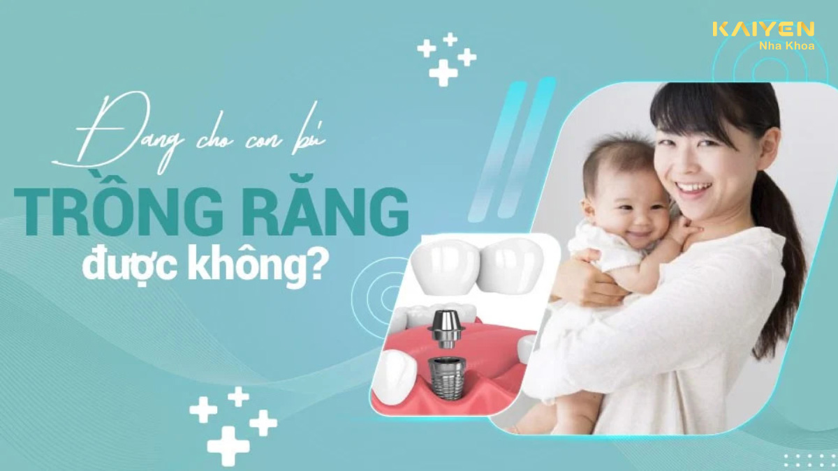 Đang cho con bú có trồng răng được không?