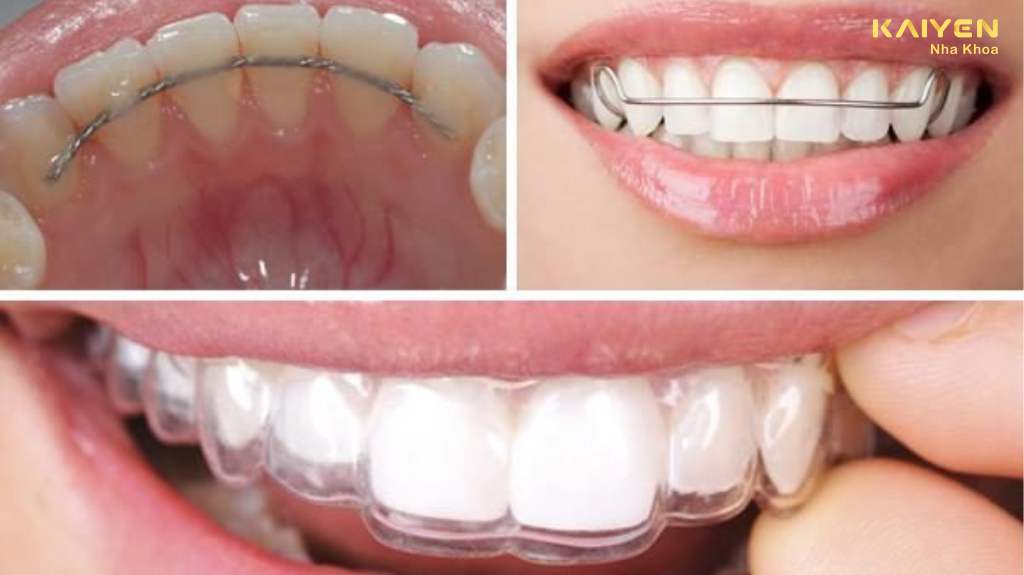 ham-duy-tri-sau-nieng-rang