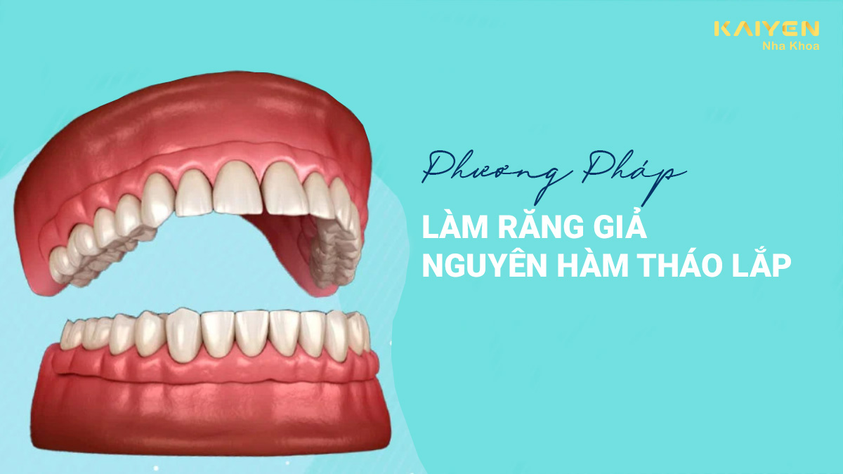 Làm răng giả nguyên hàm tháo lắp