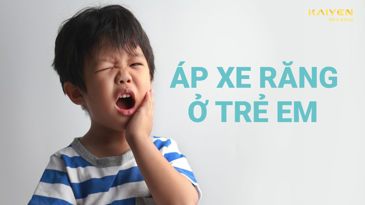 áp xe răng ở trẻ em