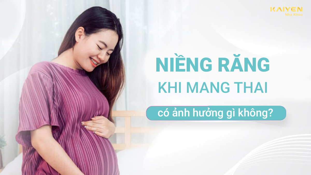 niềng răng khi mang thai