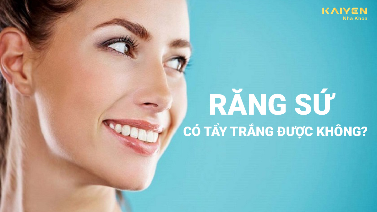 Răng sứ có tẩy trắng được không