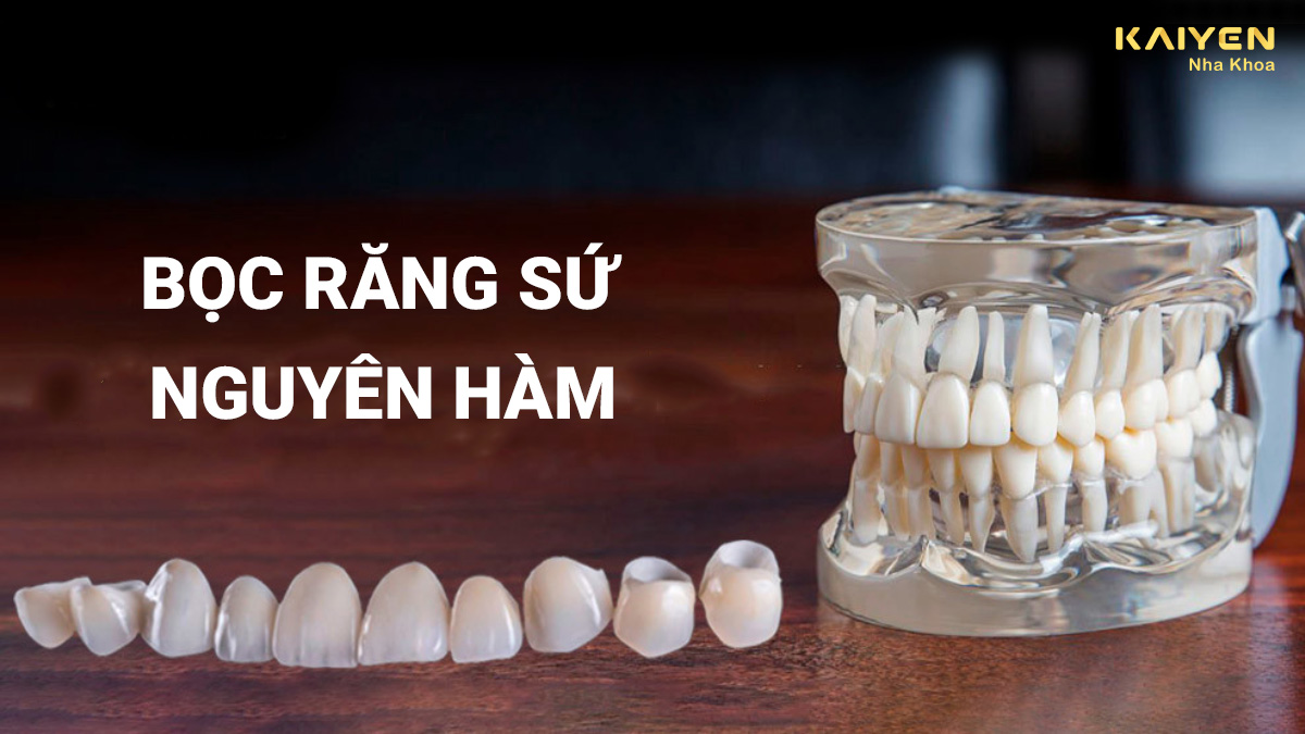 Bọc răng sứ nguyên hàm