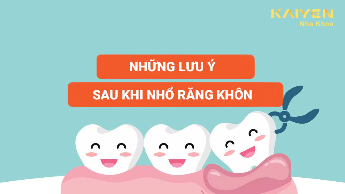 Những lưu ý sau khi nhổ răng khôn