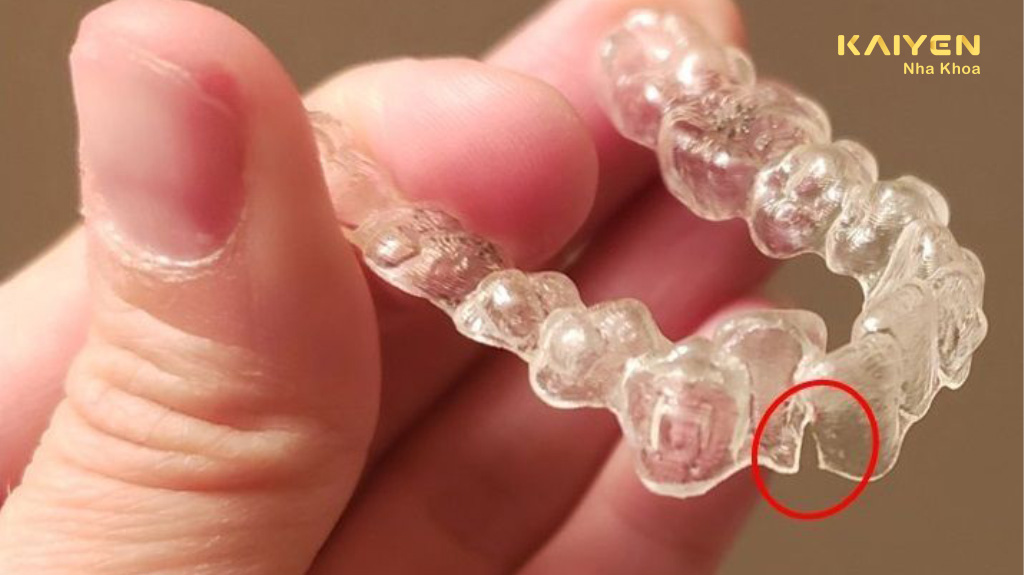 dấu hiệu nhận biết hàm duy trì trong suốt bị nứt