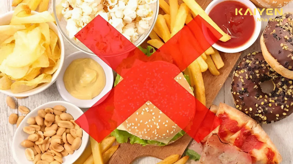 Nhổ răng khôn kiêng ăn gì