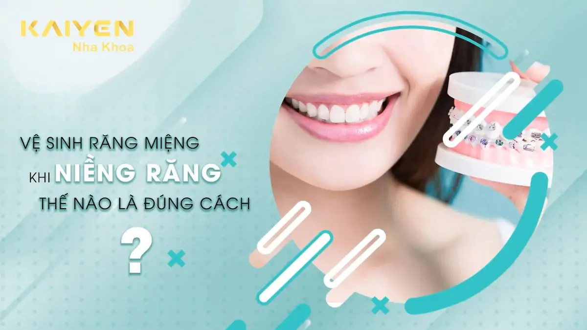 Vệ sinh răng miệng khi niềng răng