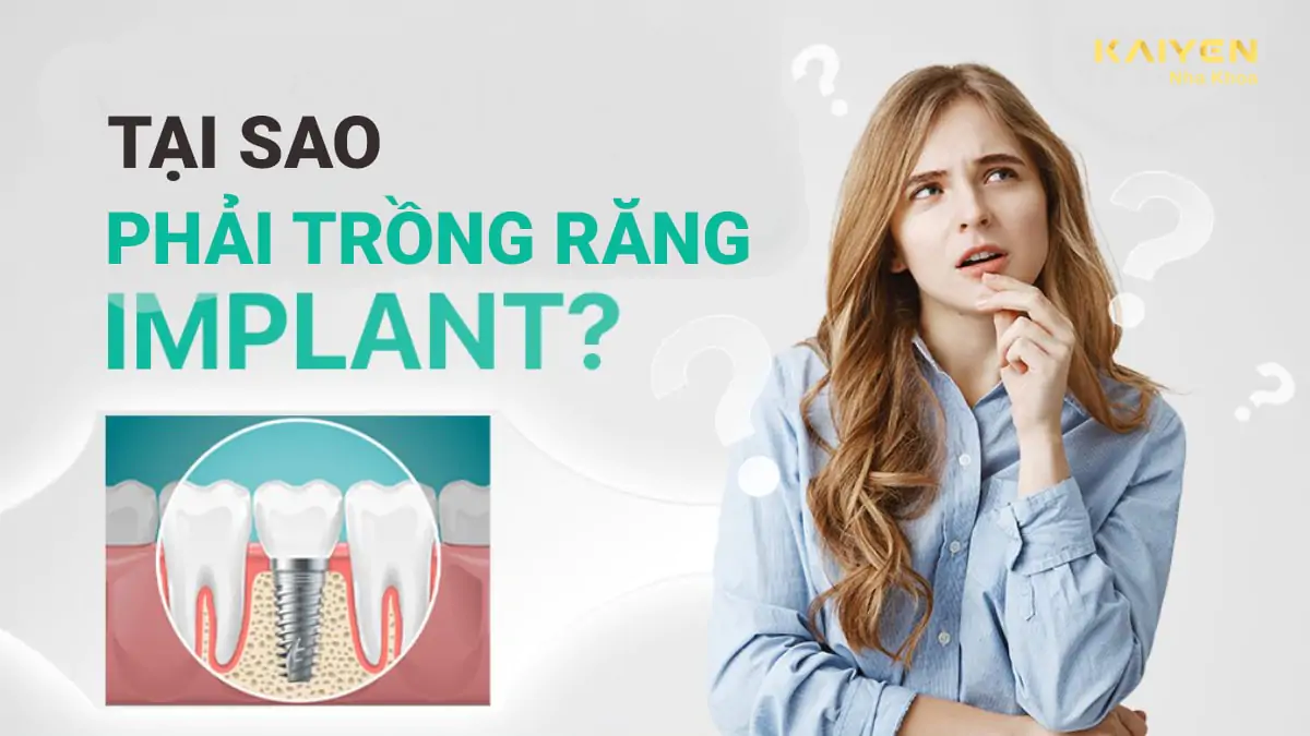 Tại sao phải trồng răng implant