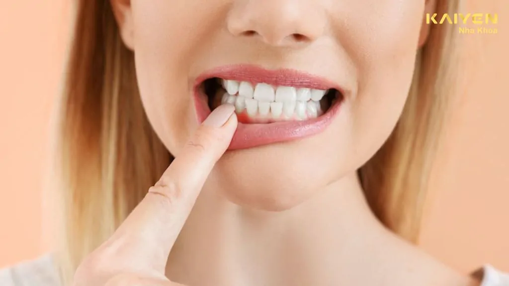 Vấn đề răng miệng