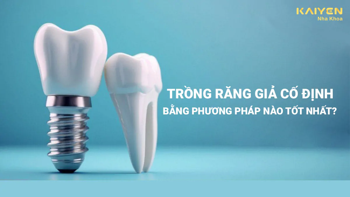 Trồng răng giá cố định