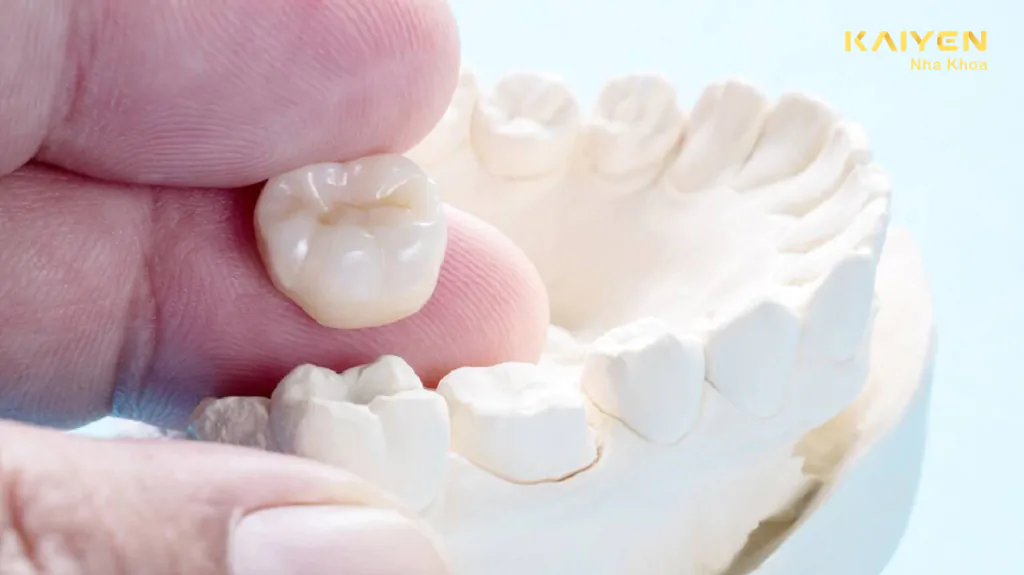 Bọc răng sứ bị rớt ra phải làm sao