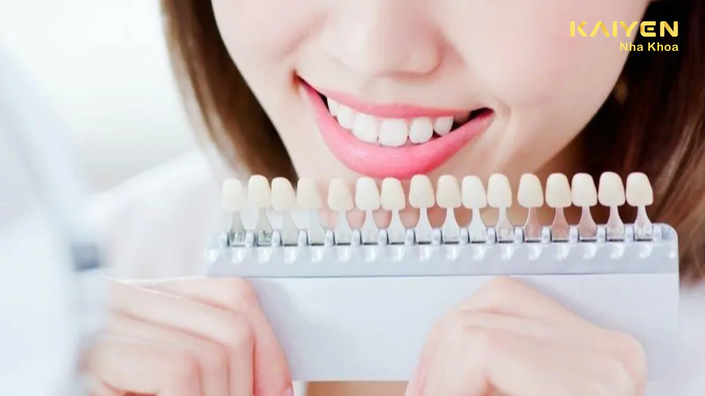 cách chọn màu răng sứ